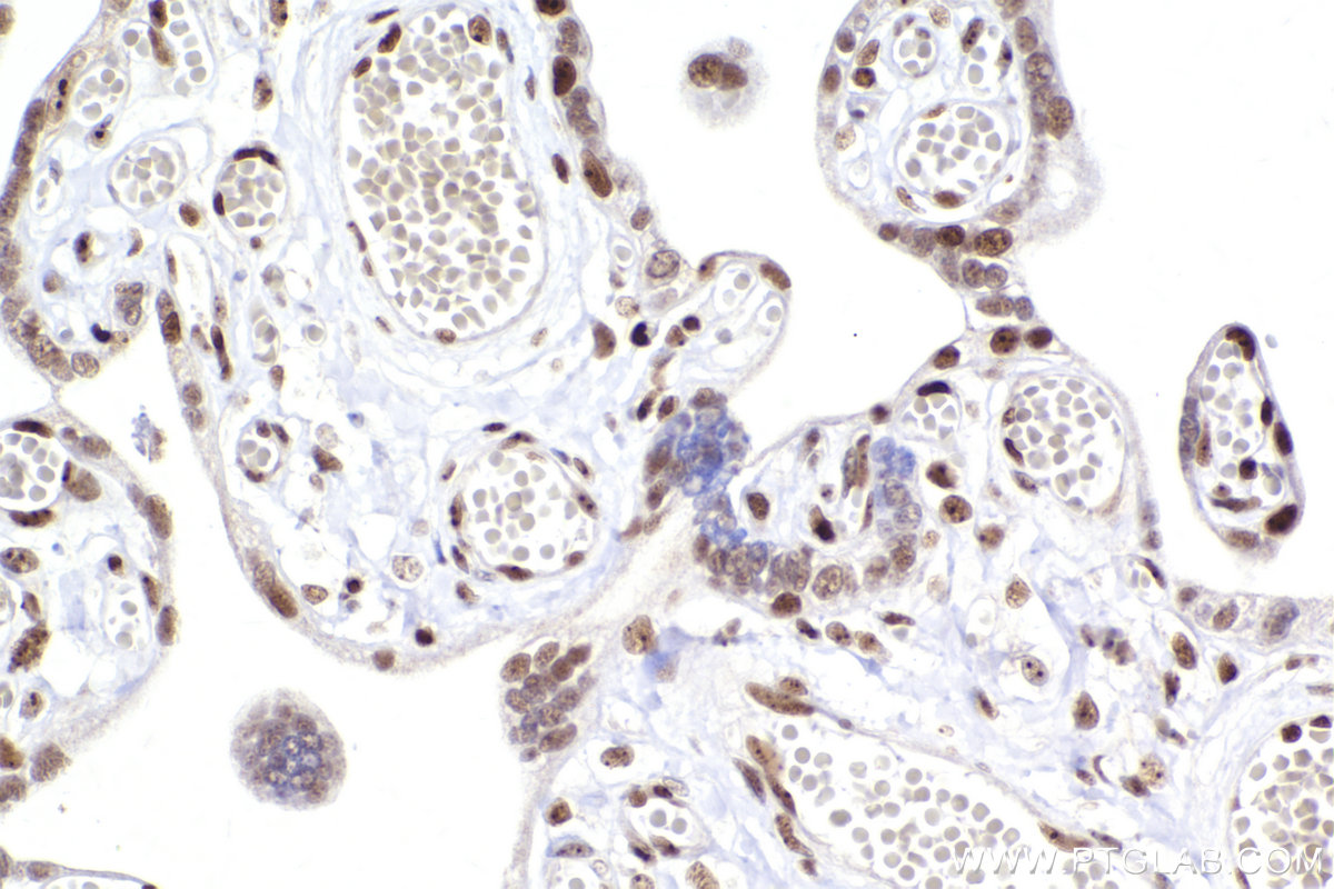 Immunohistochemical analysis of paraffin-embedded human placenta tissue slide using KHC2447 (BOP1 IHC Kit).