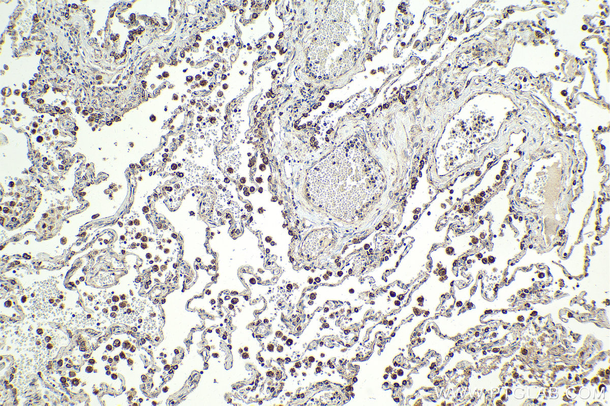 Immunohistochemical analysis of paraffin-embedded human lung tissue slide using KHC2013 (BTRC IHC Kit).