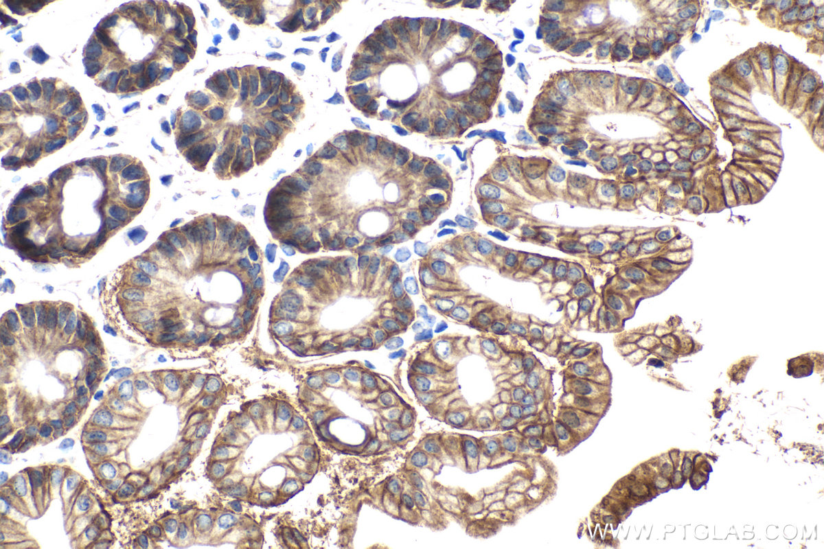 Immunohistochemical analysis of paraffin-embedded mouse small intestine tissue slide using KHC2088 (CA12 IHC Kit).