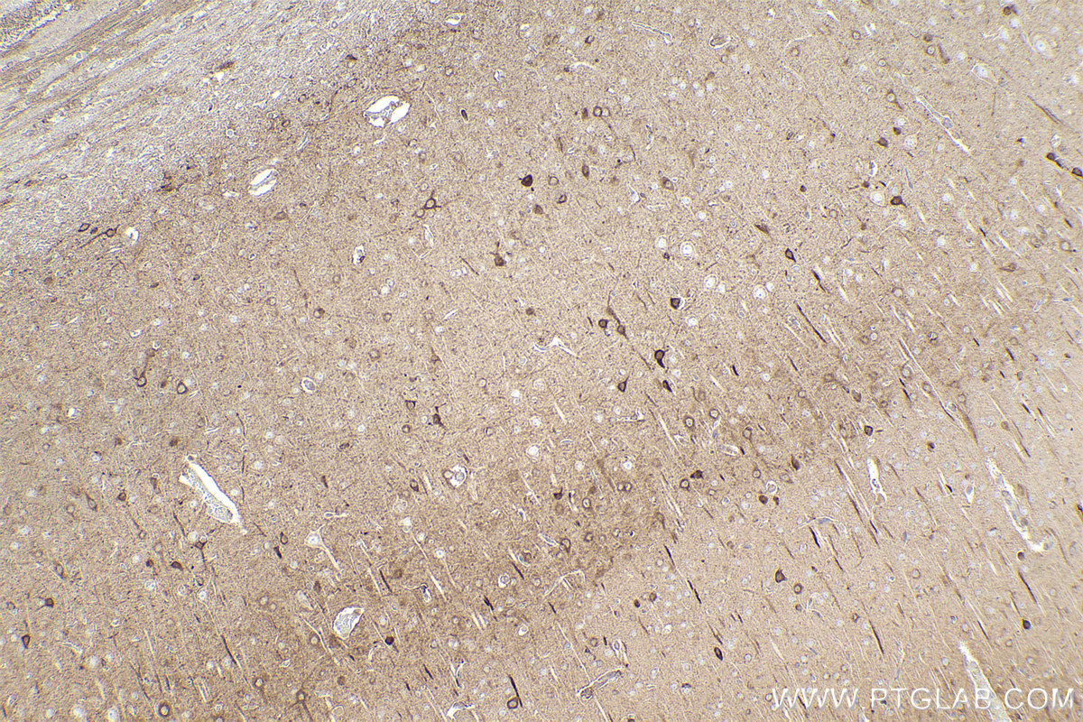 Immunohistochemical analysis of paraffin-embedded rat brain tissue slide using KHC2433 (CAMK2D IHC Kit).