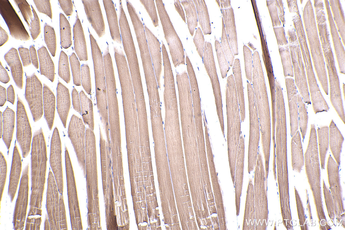 Immunohistochemical analysis of paraffin-embedded mouse skeletal muscle tissue slide using KHC2432 (CAMK2G IHC Kit).