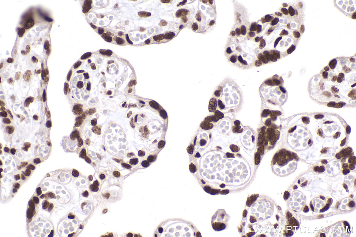 Immunohistochemical analysis of paraffin-embedded human placenta tissue slide using KHC2421 (CBX3 IHC Kit).