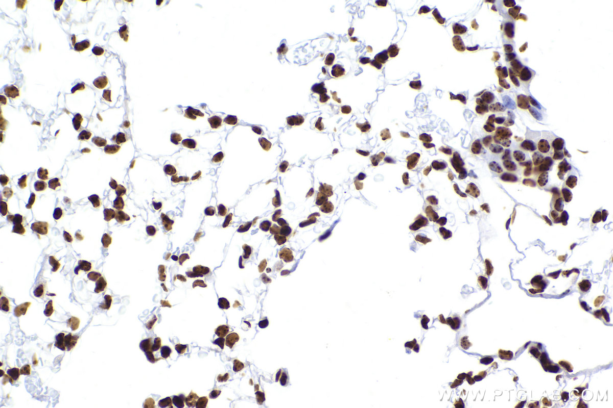 Immunohistochemical analysis of paraffin-embedded mouse lung tissue slide using KHC2421 (CBX3 IHC Kit).