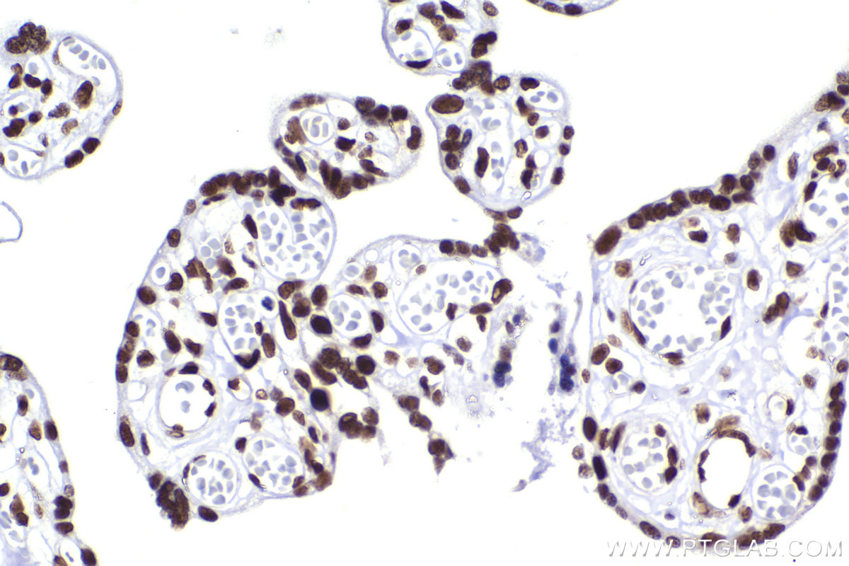 Immunohistochemical analysis of paraffin-embedded human placenta tissue slide using KHC2266 (CBX5 IHC Kit).