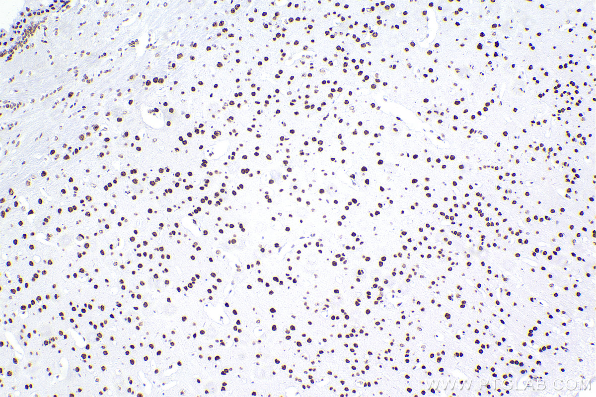 Immunohistochemical analysis of paraffin-embedded mouse brain tissue slide using KHC2266 (CBX5 IHC Kit).