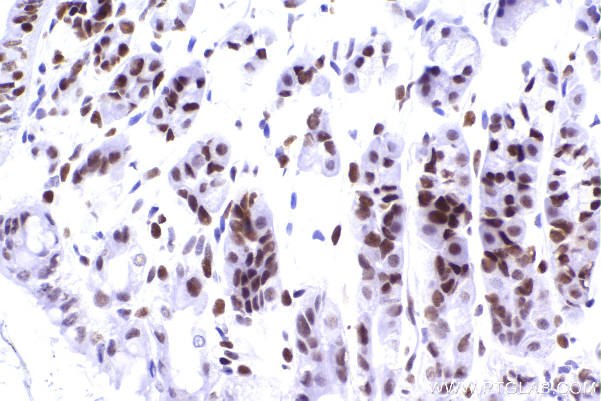 Immunohistochemical analysis of paraffin-embedded mouse stomach tissue slide using KHC2266 (CBX5 IHC Kit).