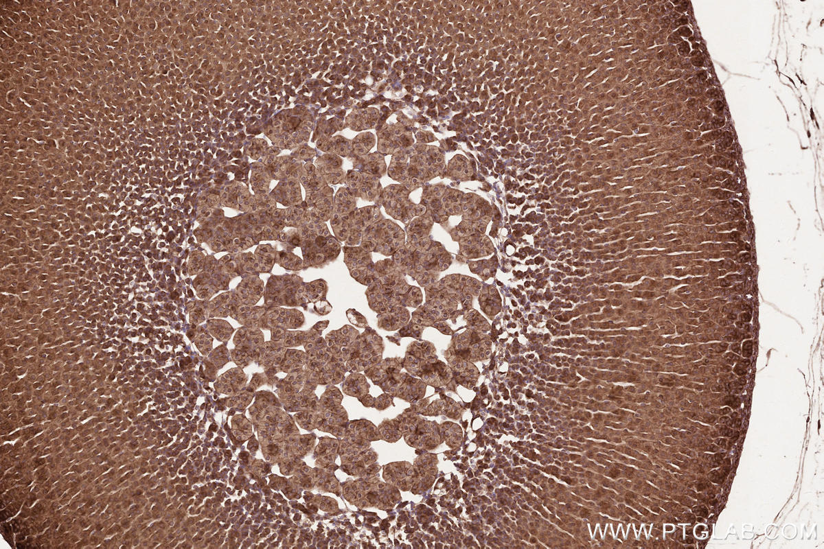 Immunohistochemical analysis of paraffin-embedded mouse adrenal gland tissue slide using KHC2538 (CCDC93 IHC Kit).