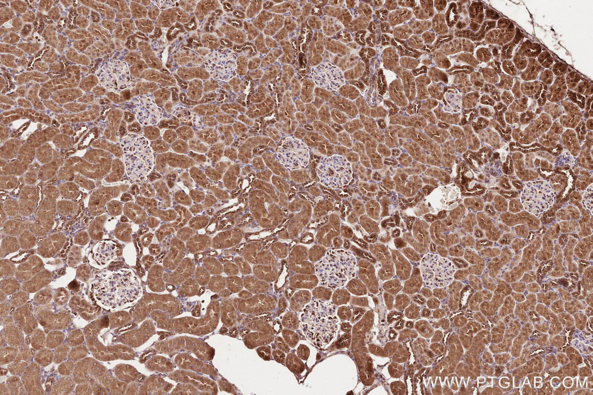 Immunohistochemical analysis of paraffin-embedded rat kidney tissue slide using KHC2538 (CCDC93 IHC Kit).