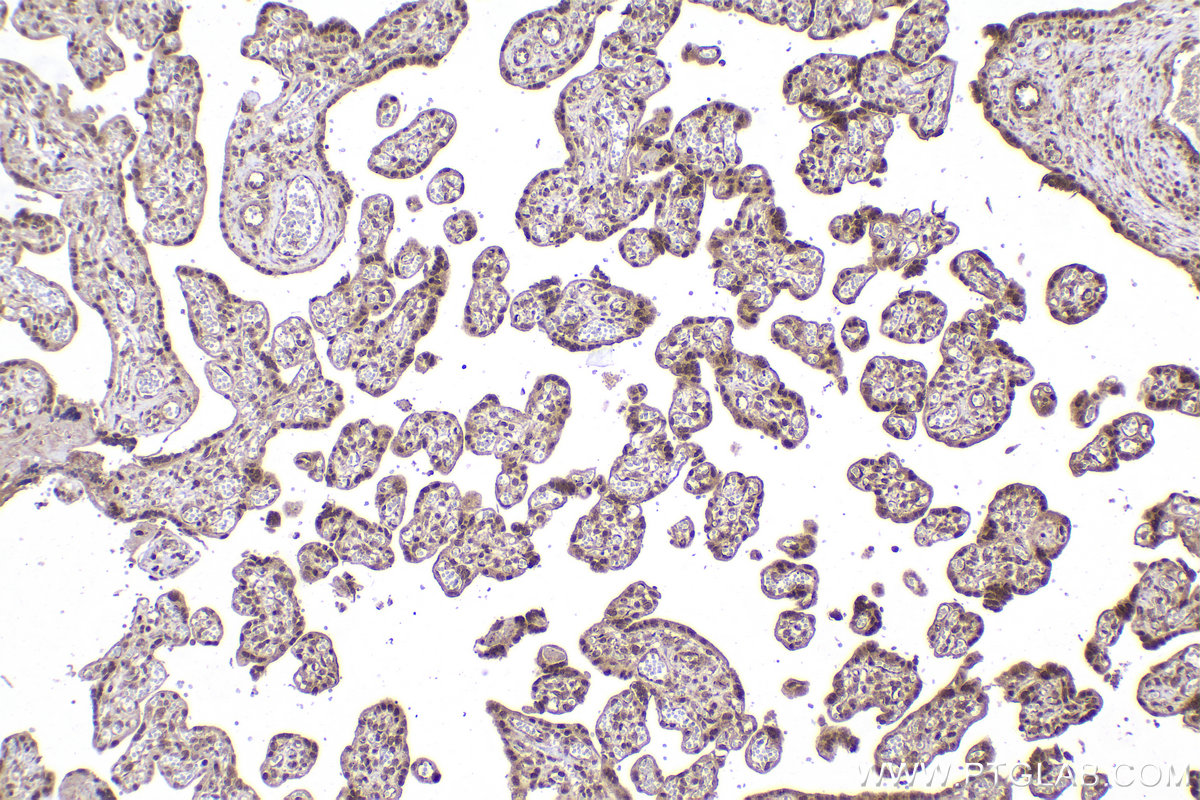 Immunohistochemical analysis of paraffin-embedded human placenta tissue slide using KHC2185 (CCNB1 IHC Kit).