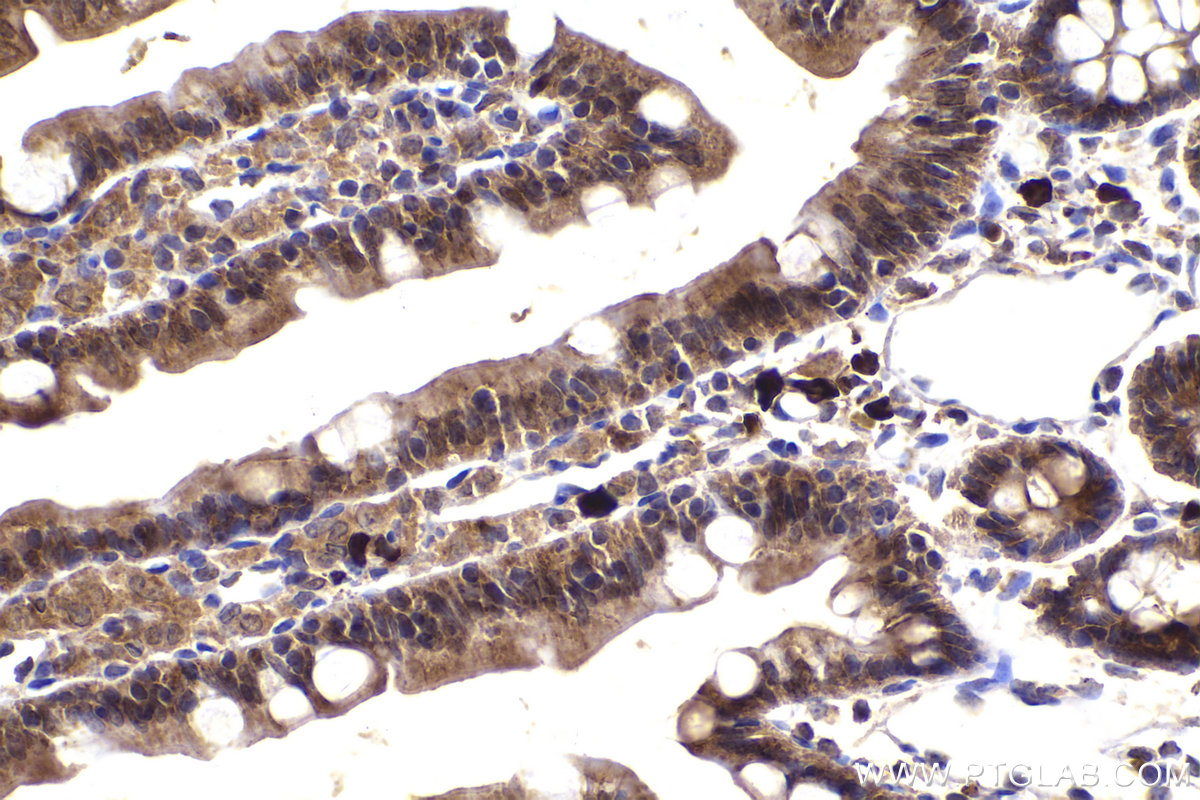Immunohistochemical analysis of paraffin-embedded rat small intestine tissue slide using KHC2185 (CCNB1 IHC Kit).
