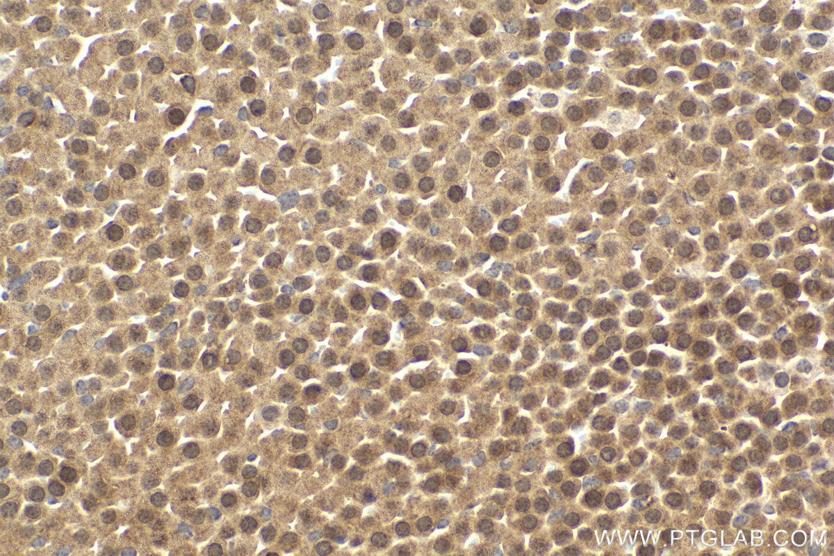 Immunohistochemical analysis of paraffin-embedded mouse adrenal gland tissue slide using KHC2132 (CCNB2 IHC Kit).