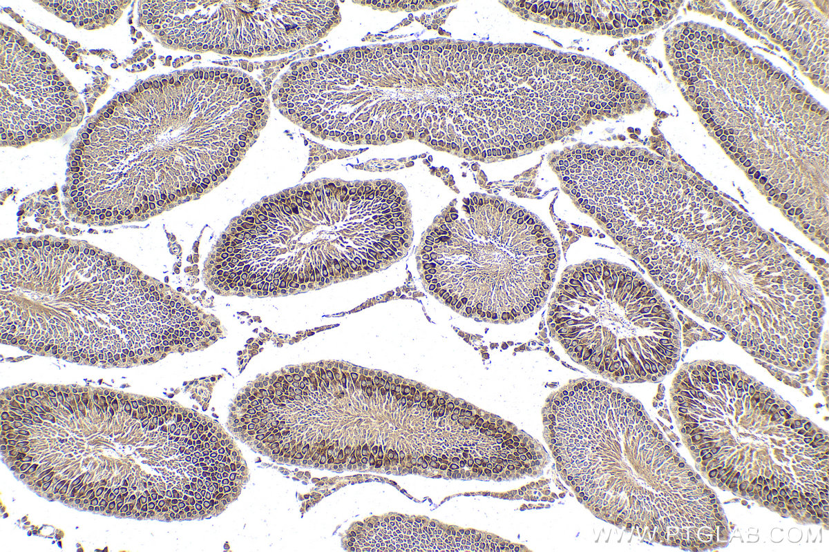 Immunohistochemical analysis of paraffin-embedded rat testis tissue slide using KHC2132 (CCNB2 IHC Kit).