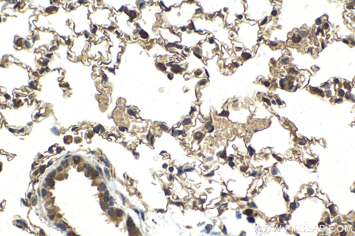 Immunohistochemical analysis of paraffin-embedded mouse lung tissue slide using KHC2138 (CCNDBP1 IHC Kit).