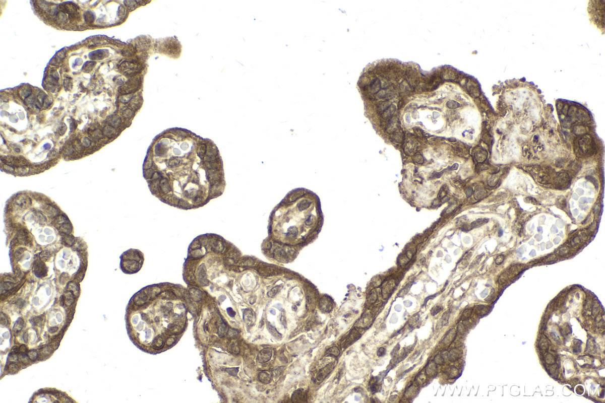 Immunohistochemical analysis of paraffin-embedded human placenta tissue slide using KHC2138 (CCNDBP1 IHC Kit).