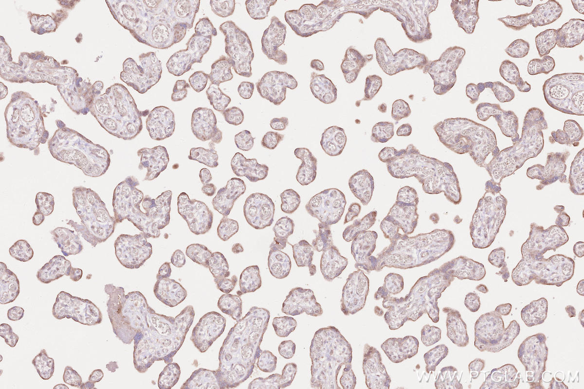 Immunohistochemical analysis of paraffin-embedded human placenta tissue slide using KHC2581 (CCSAP IHC Kit).