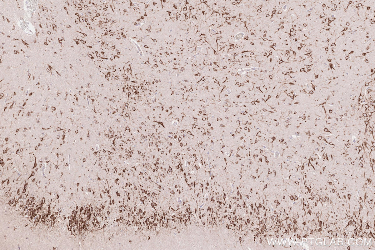 Immunohistochemical analysis of paraffin-embedded rat brain tissue slide using KHC2581 (CCSAP IHC Kit).