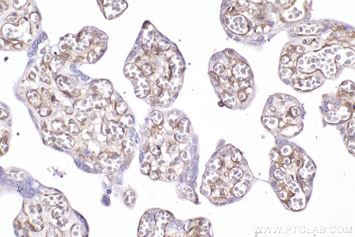 Immunohistochemical analysis of paraffin-embedded human placenta tissue slide using KHC2274 (CD146/MCAM IHC Kit).