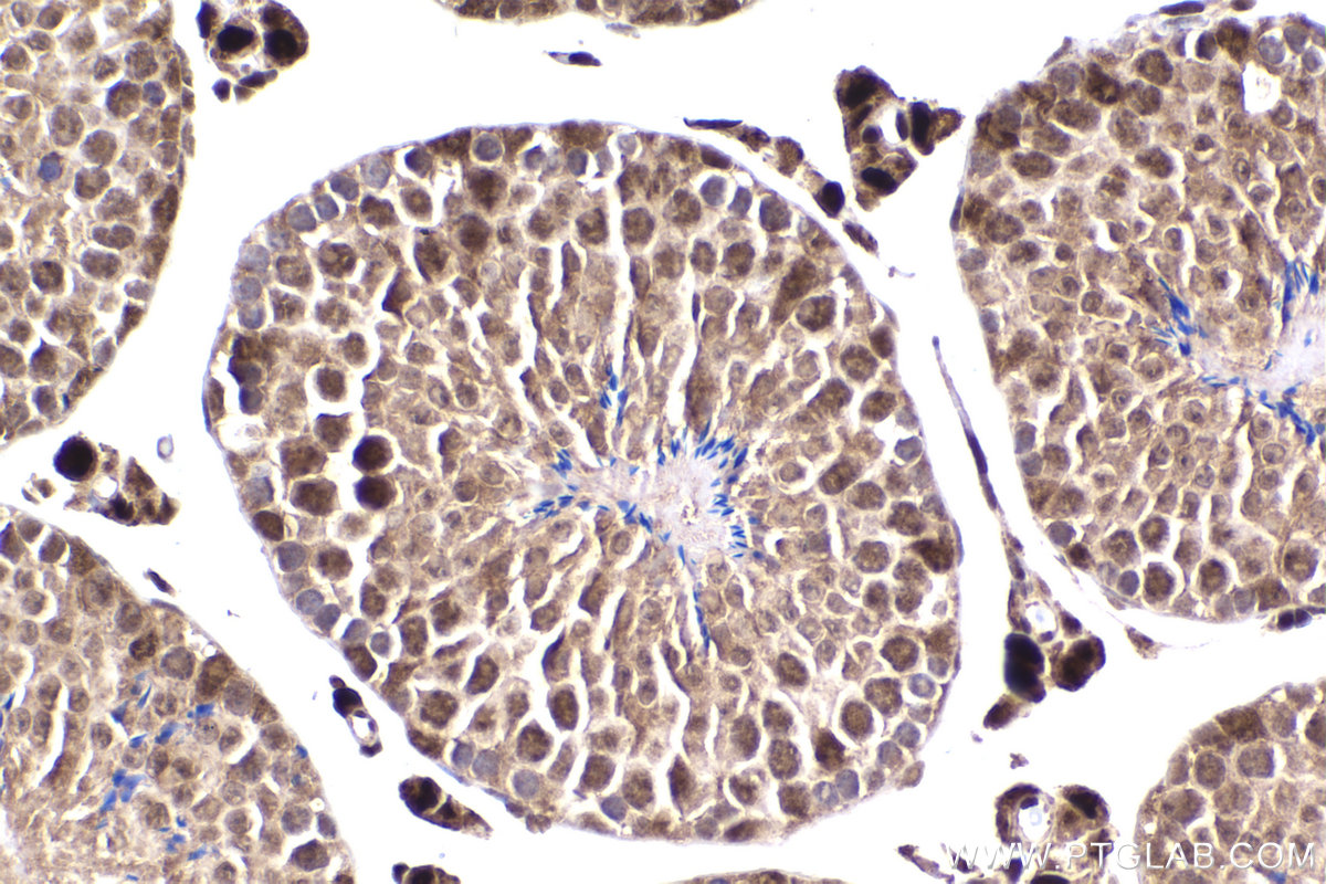 Immunohistochemical analysis of paraffin-embedded mouse testis tissue slide using KHC2228 (CDC25A IHC Kit).