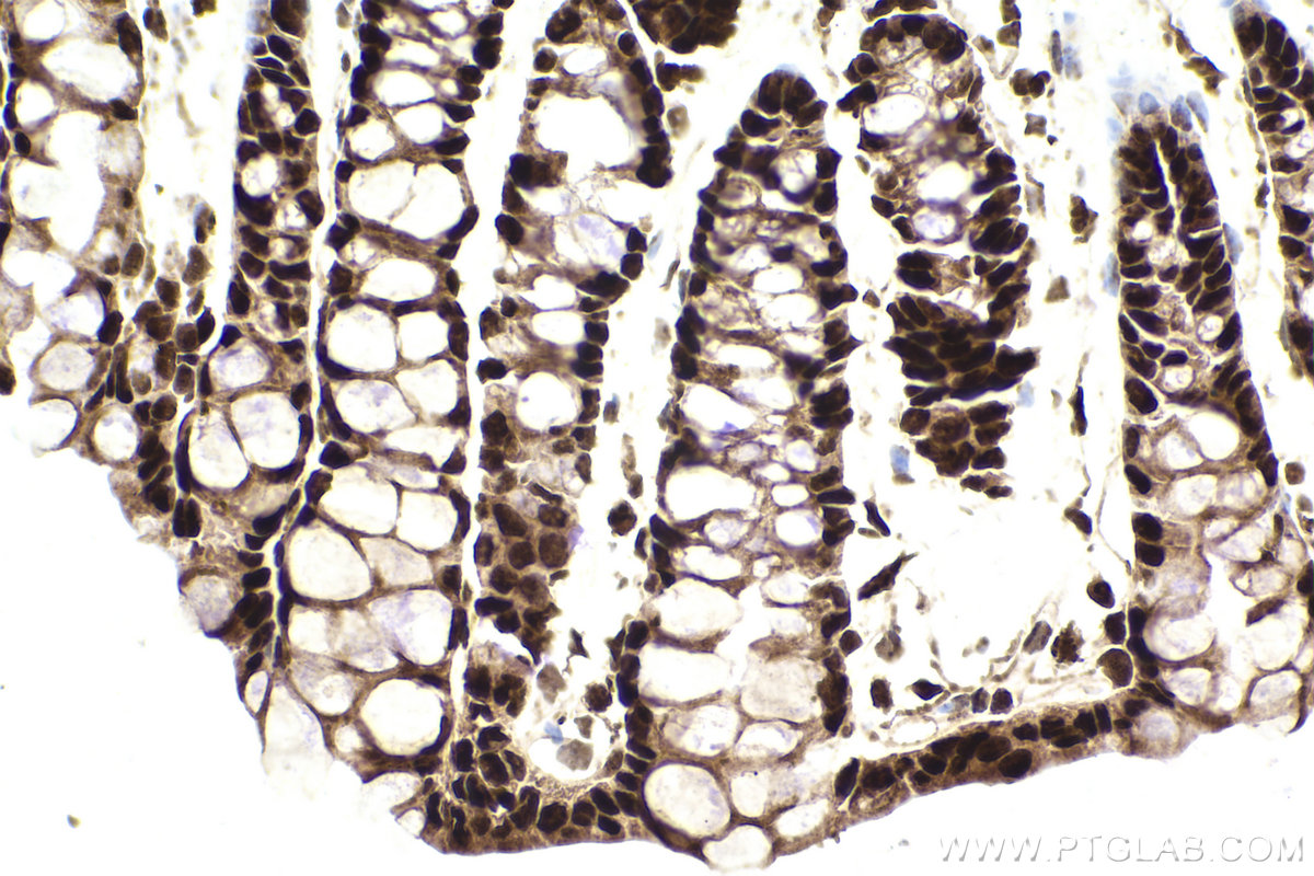 Immunohistochemical analysis of paraffin-embedded mouse colon tissue slide using KHC2228 (CDC25A IHC Kit).