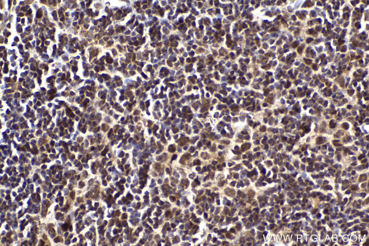 Immunohistochemical analysis of paraffin-embedded mouse thymus tissue slide using KHC2228 (CDC25A IHC Kit).