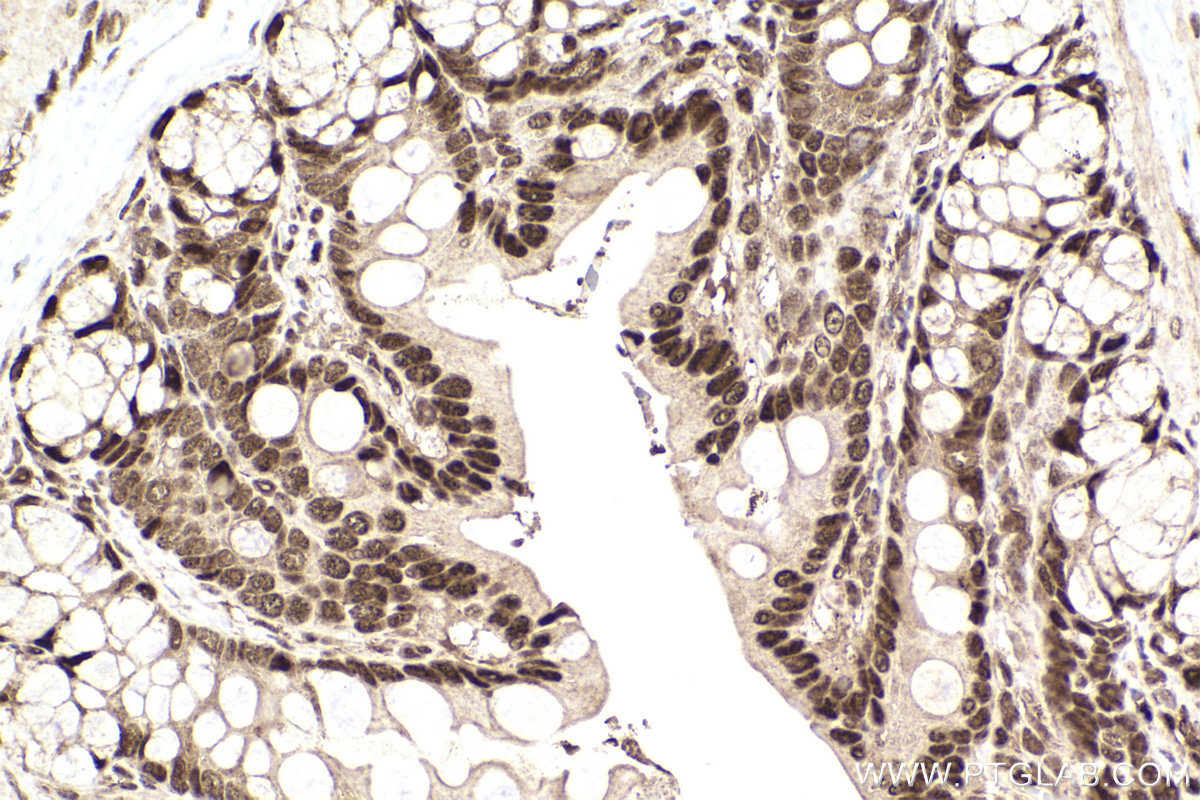 Immunohistochemical analysis of paraffin-embedded rat colon tissue slide using KHC2228 (CDC25A IHC Kit).