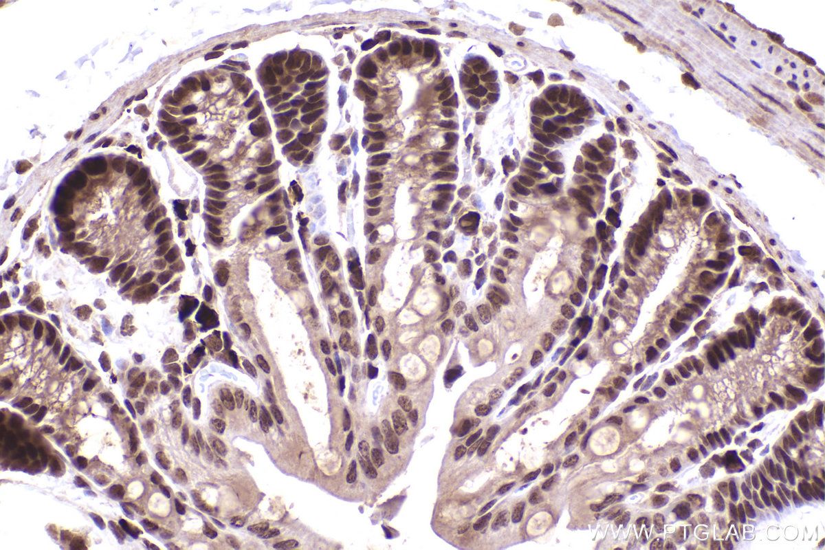 Immunohistochemical analysis of paraffin-embedded mouse colon tissue slide using KHC2227 (CDC27 IHC Kit).