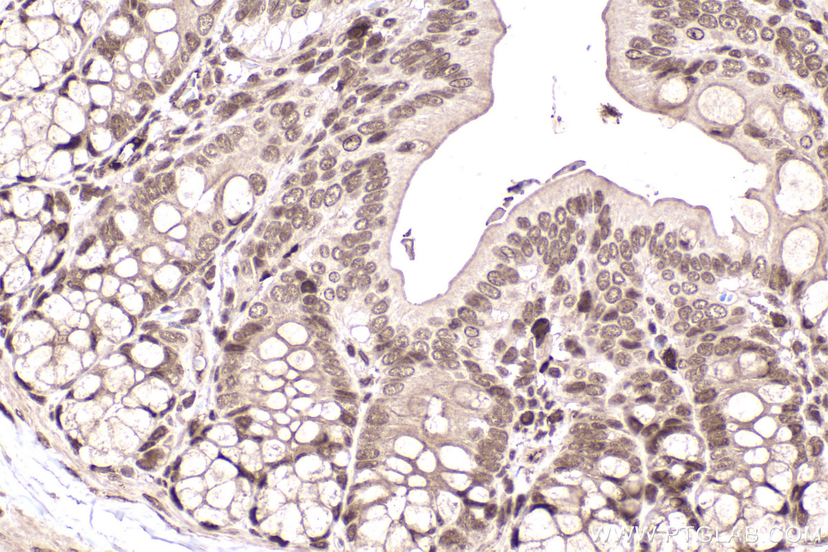 Immunohistochemical analysis of paraffin-embedded rat colon tissue slide using KHC2227 (CDC27 IHC Kit).