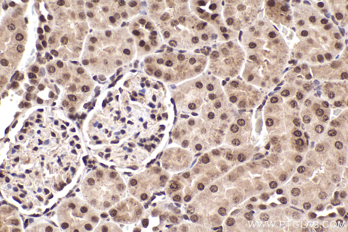 Immunohistochemical analysis of paraffin-embedded rat kidney tissue slide using KHC2227 (CDC27 IHC Kit).