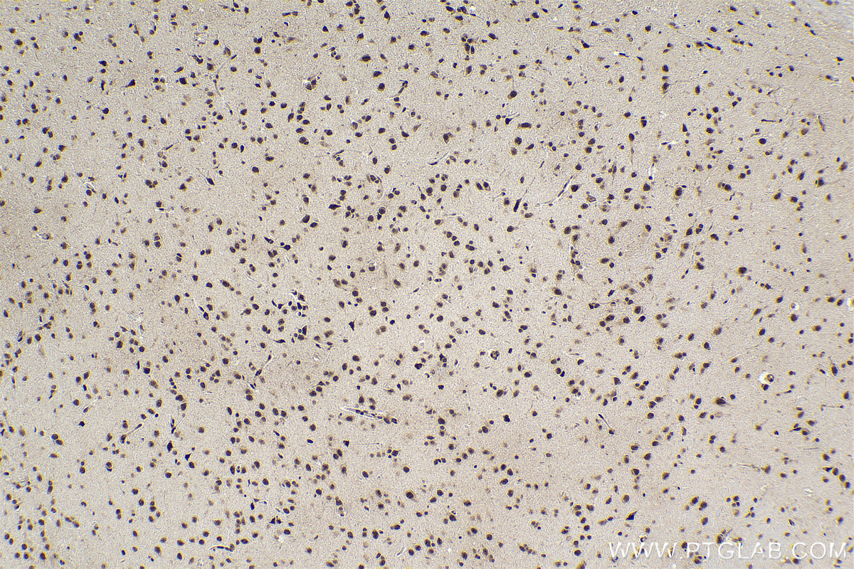 Immunohistochemical analysis of paraffin-embedded rat brain tissue slide using KHC2204 (CDC2L1 IHC Kit).