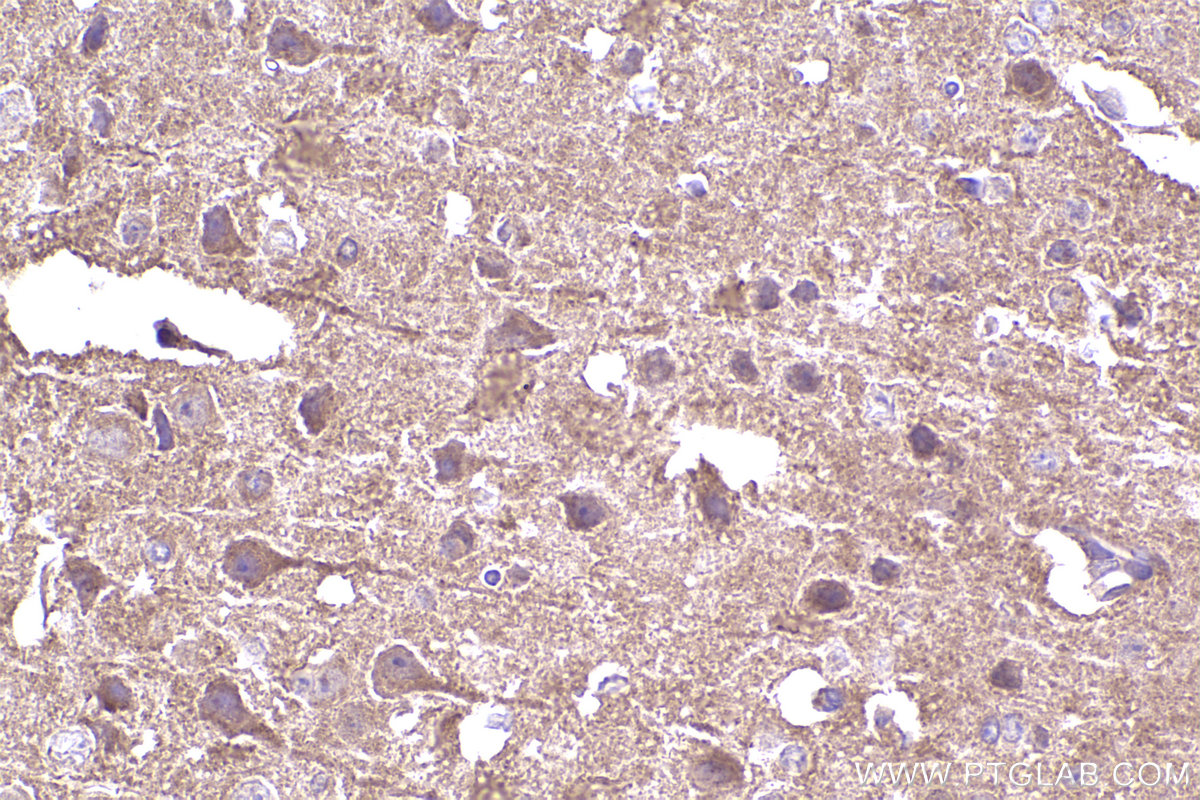 Immunohistochemical analysis of paraffin-embedded mouse brain tissue slide using KHC2336 (CDC42 IHC Kit).