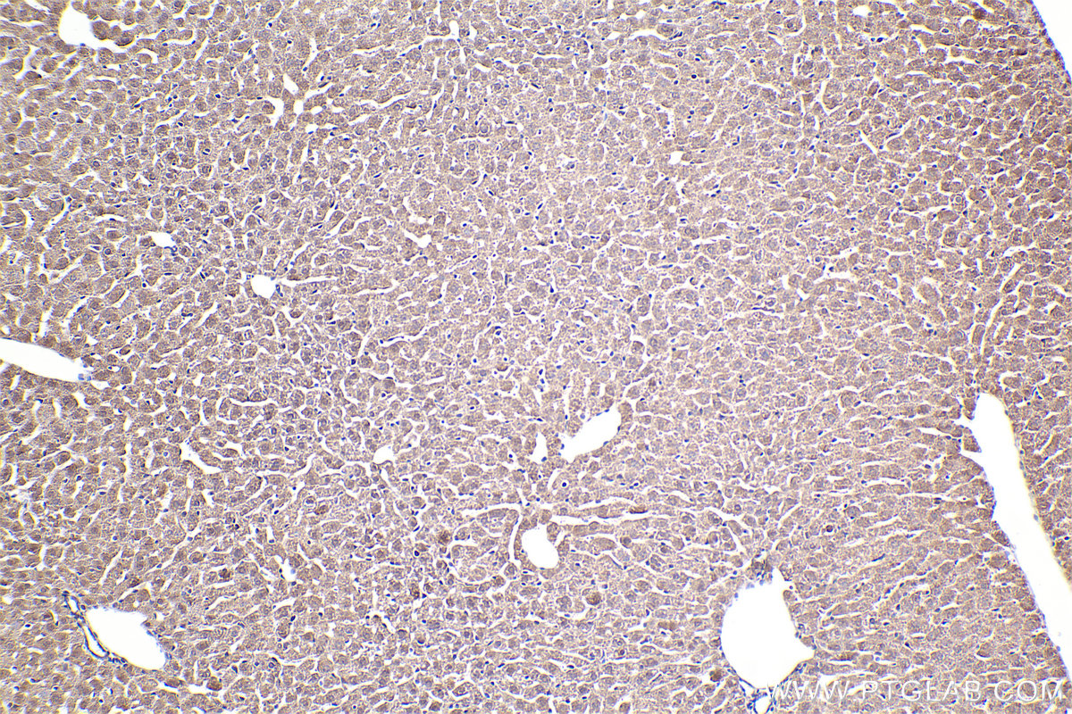 Immunohistochemical analysis of paraffin-embedded mouse liver tissue slide using KHC2480 (CDK10 IHC Kit).