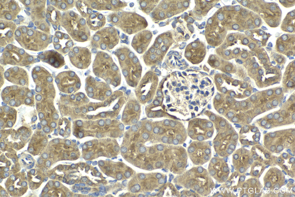 Immunohistochemical analysis of paraffin-embedded mouse kidney tissue slide using KHC2130 (CDK14/PFTK1 IHC Kit).