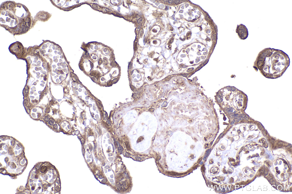 Immunohistochemical analysis of paraffin-embedded human placenta tissue slide using KHC2212 (CDK2 IHC Kit).