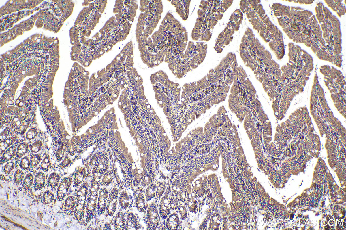 Immunohistochemical analysis of paraffin-embedded rat small intestine tissue slide using KHC2212 (CDK2 IHC Kit).