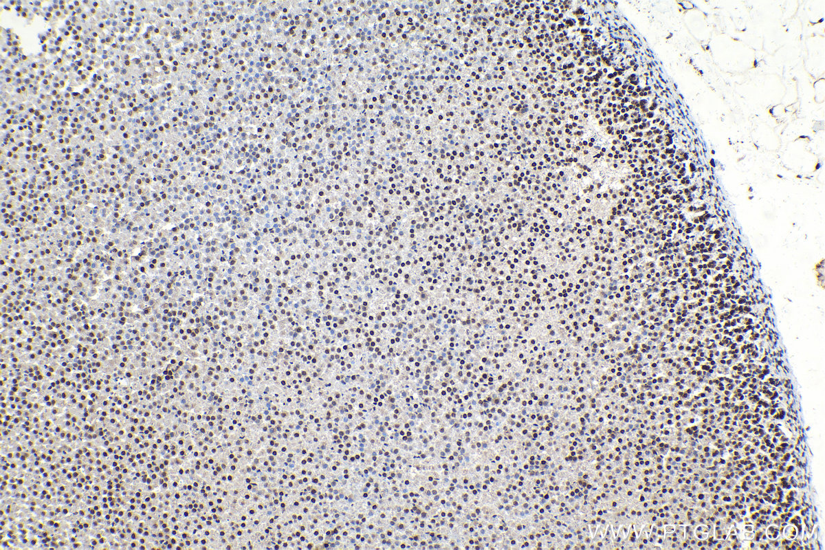 Immunohistochemical analysis of paraffin-embedded rat adrenal gland tissue slide using KHC2124 (CDK2AP2 IHC Kit).