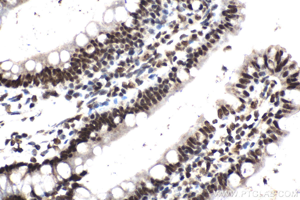 Immunohistochemical analysis of paraffin-embedded rat small intestine tissue slide using KHC2124 (CDK2AP2 IHC Kit).