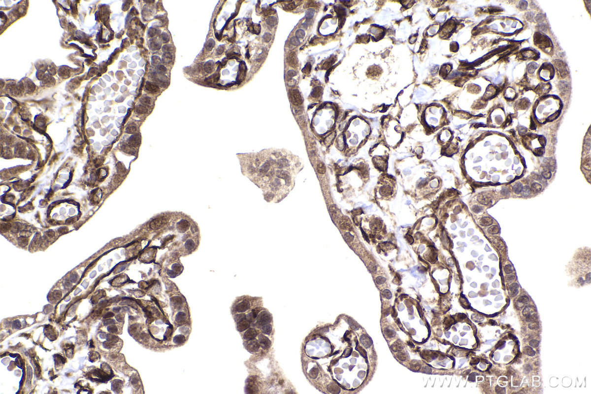 Immunohistochemical analysis of paraffin-embedded human placenta tissue slide using KHC2255 (CDKN1A/P21 IHC Kit).