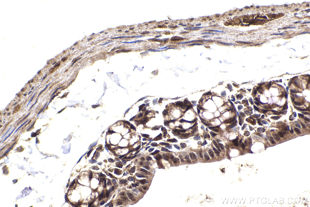 Immunohistochemical analysis of paraffin-embedded mouse small intestine tissue slide using KHC2255 (CDKN1A/P21 IHC Kit).