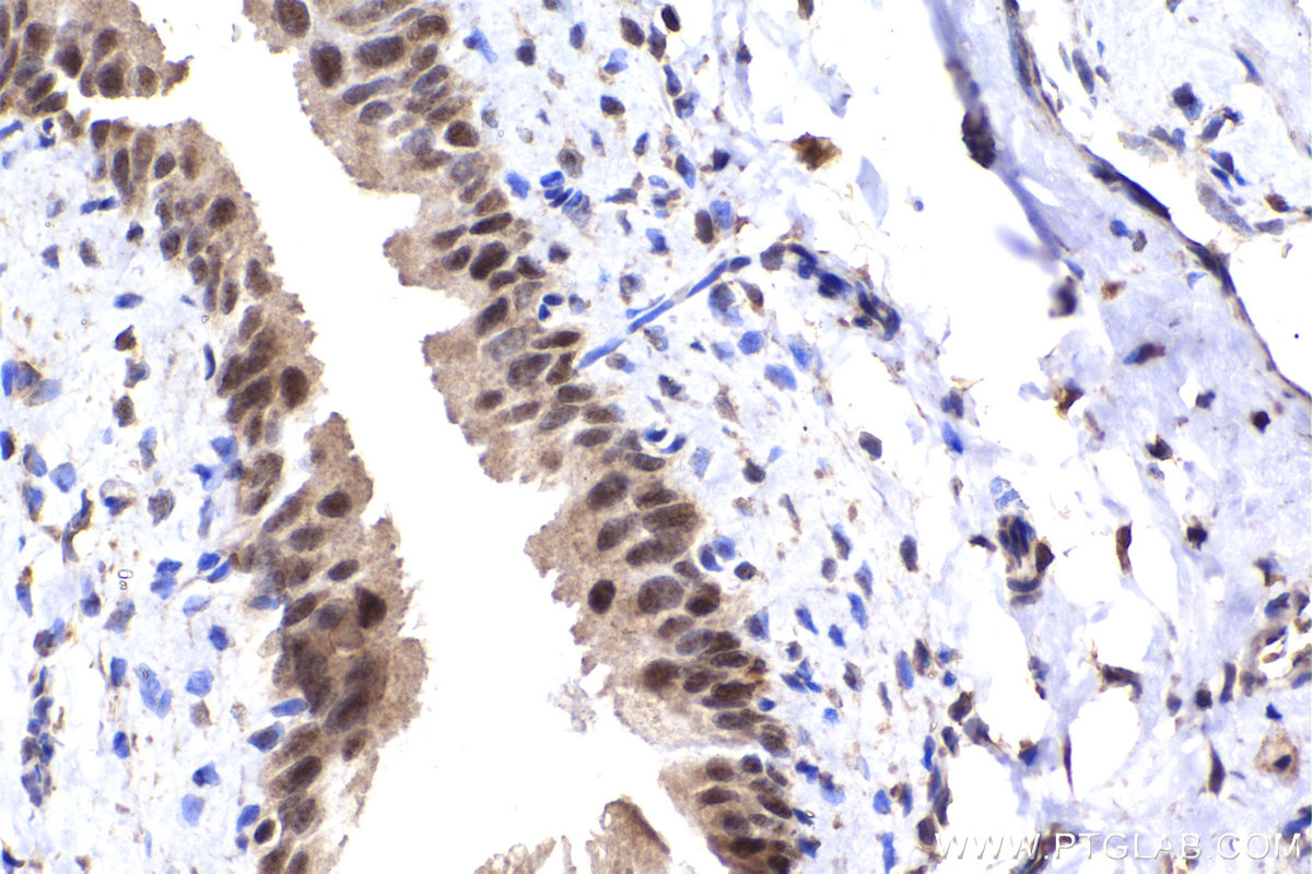 Immunohistochemical analysis of paraffin-embedded rat bladder tissue slide using KHC2255 (CDKN1A/P21 IHC Kit).