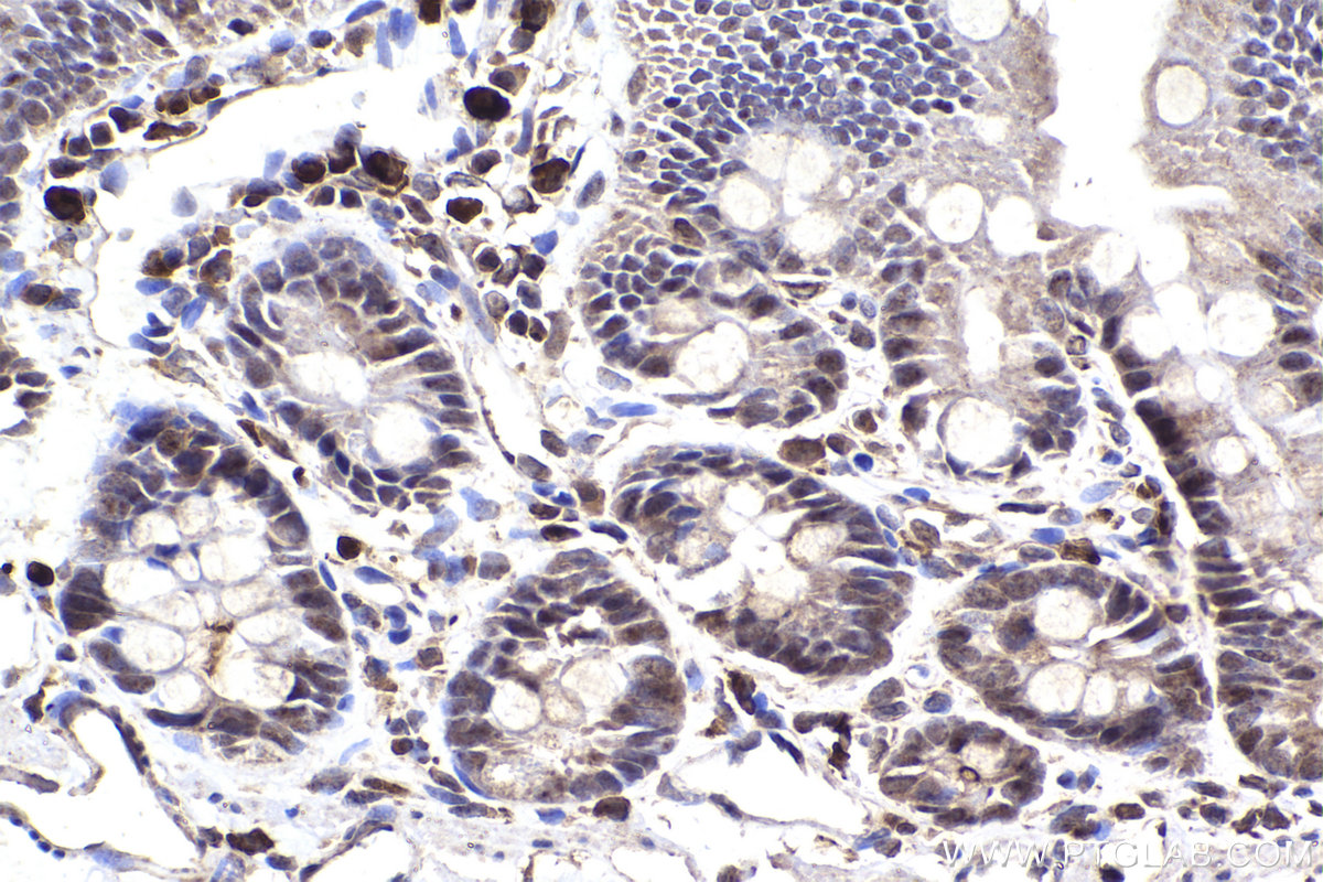 Immunohistochemical analysis of paraffin-embedded rat small intestine tissue slide using KHC2255 (CDKN1A/P21 IHC Kit).