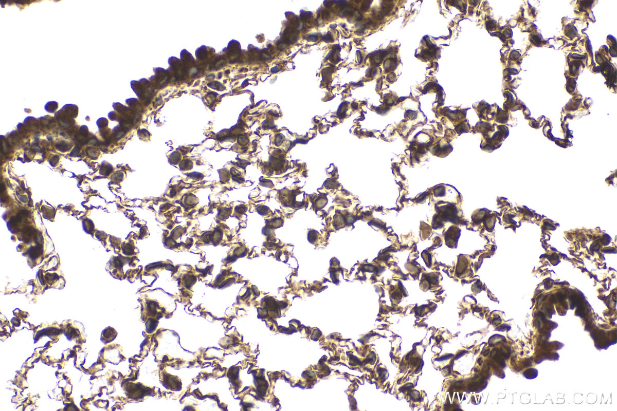 Immunohistochemical analysis of paraffin-embedded mouse lung tissue slide using KHC2146 (CDS2 IHC Kit).