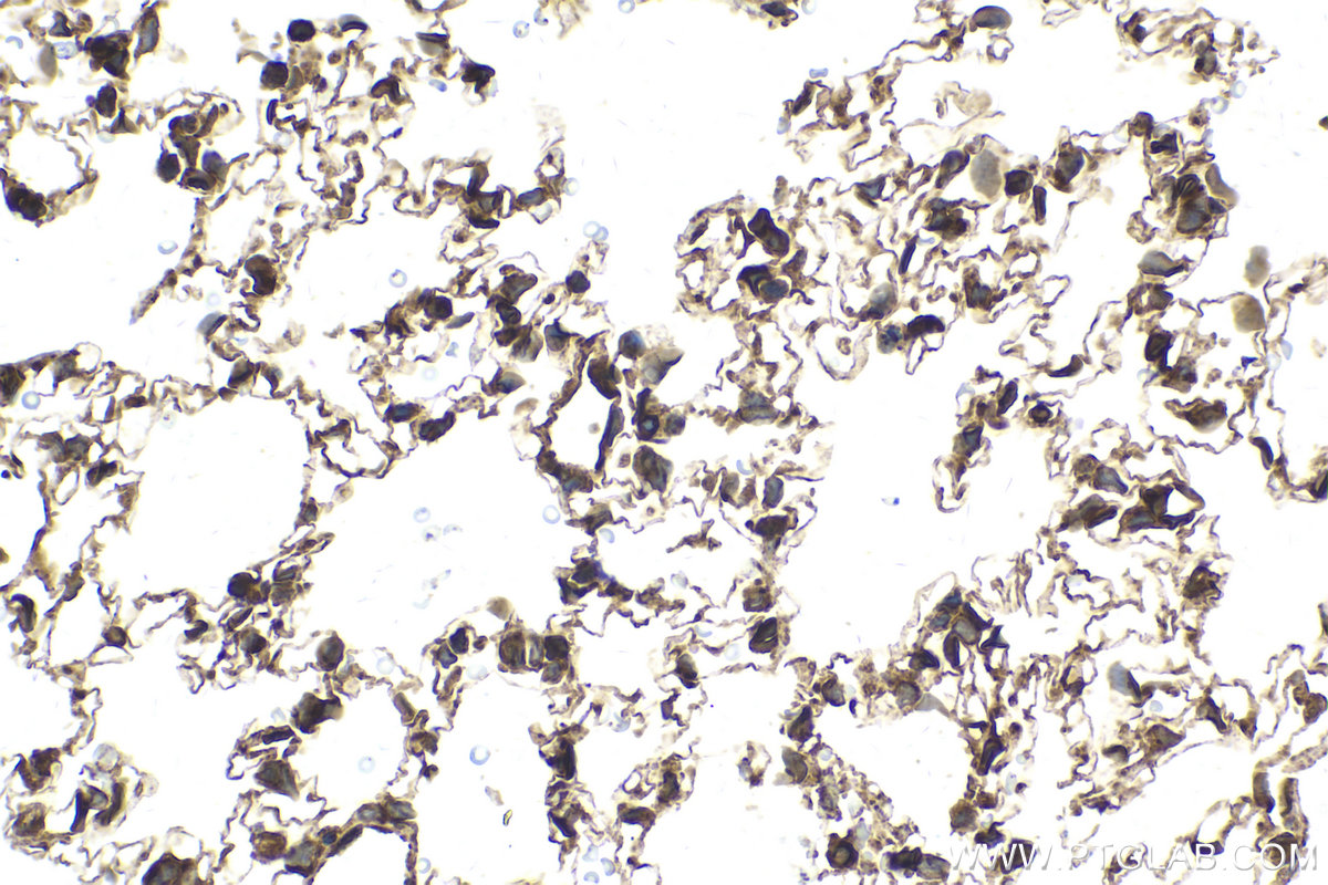 Immunohistochemical analysis of paraffin-embedded rat lung tissue slide using KHC2146 (CDS2 IHC Kit).