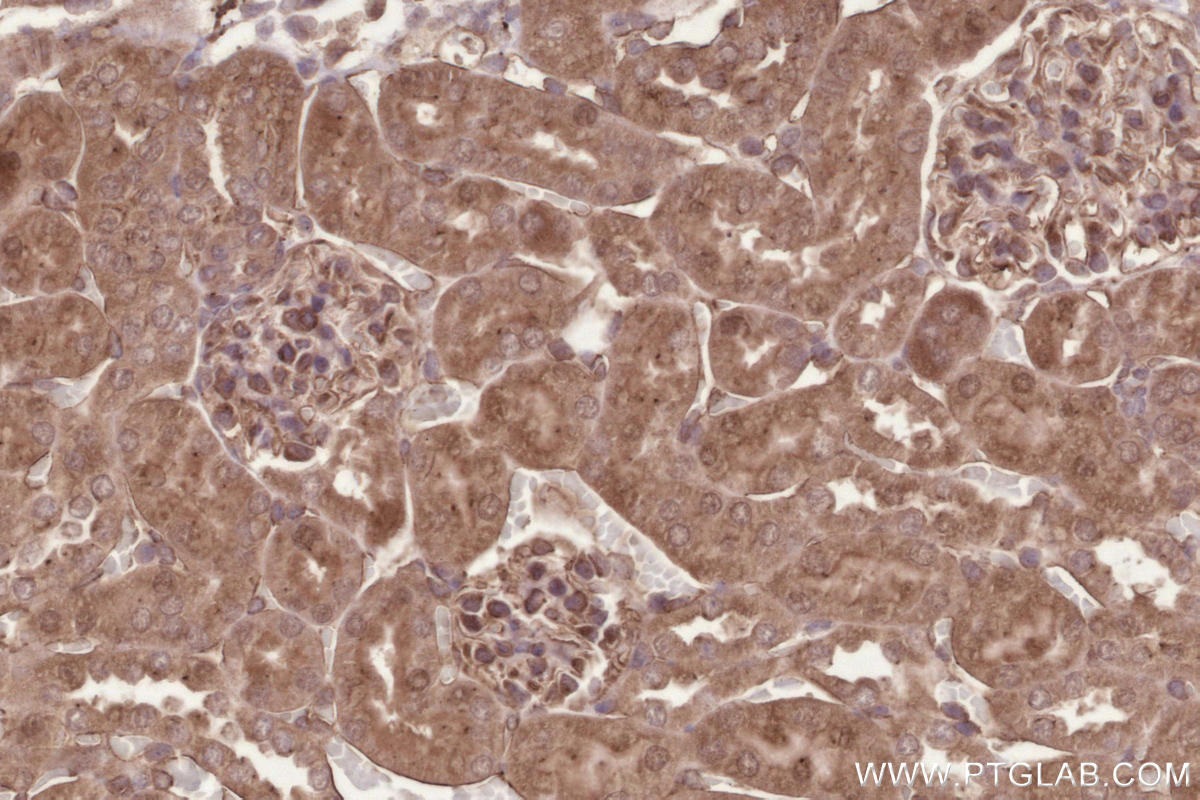 Immunohistochemical analysis of paraffin-embedded mouse kidney tissue slide using KHC2611 (CEP68 IHC Kit).