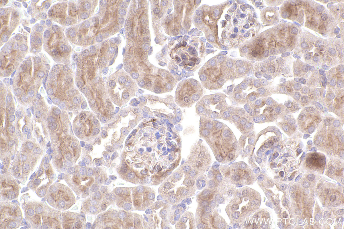 Immunohistochemical analysis of paraffin-embedded mouse kidney tissue slide using KHC2547 (CEP78 IHC Kit).