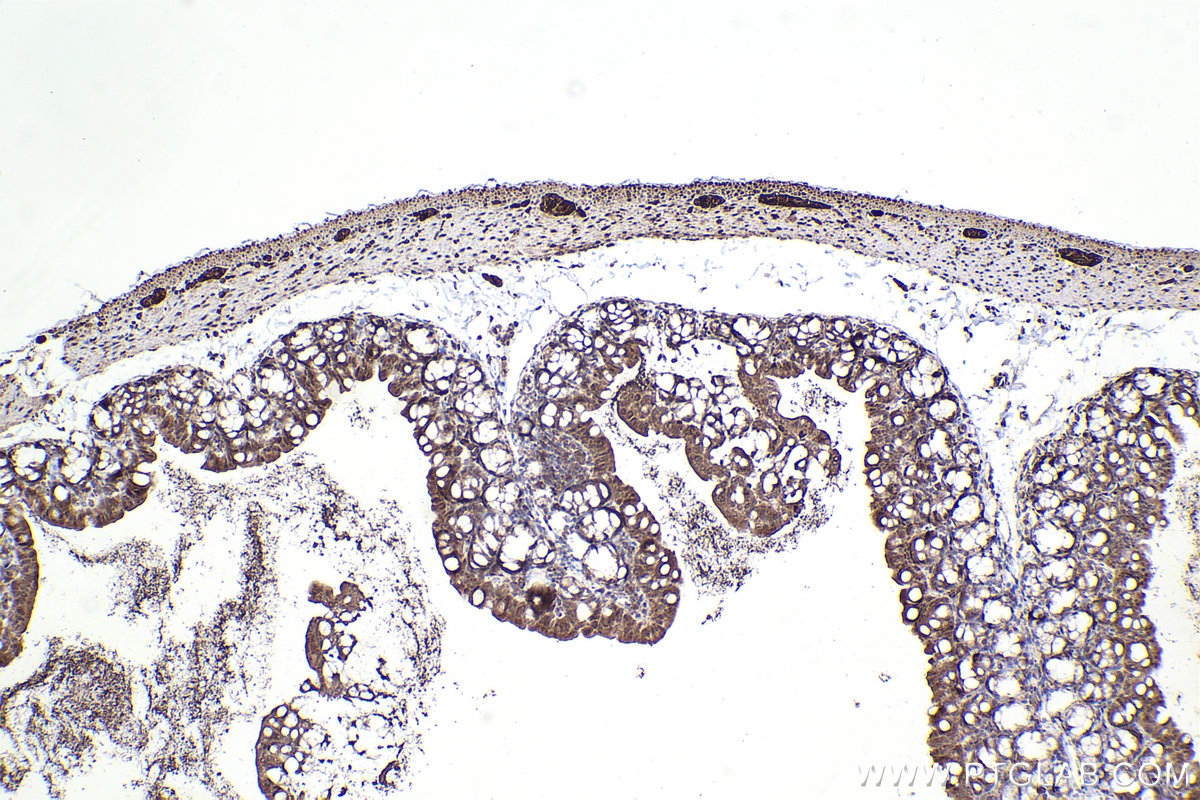 Immunohistochemical analysis of paraffin-embedded mouse small intestine tissue slide using KHC2217 (CHAT IHC Kit).