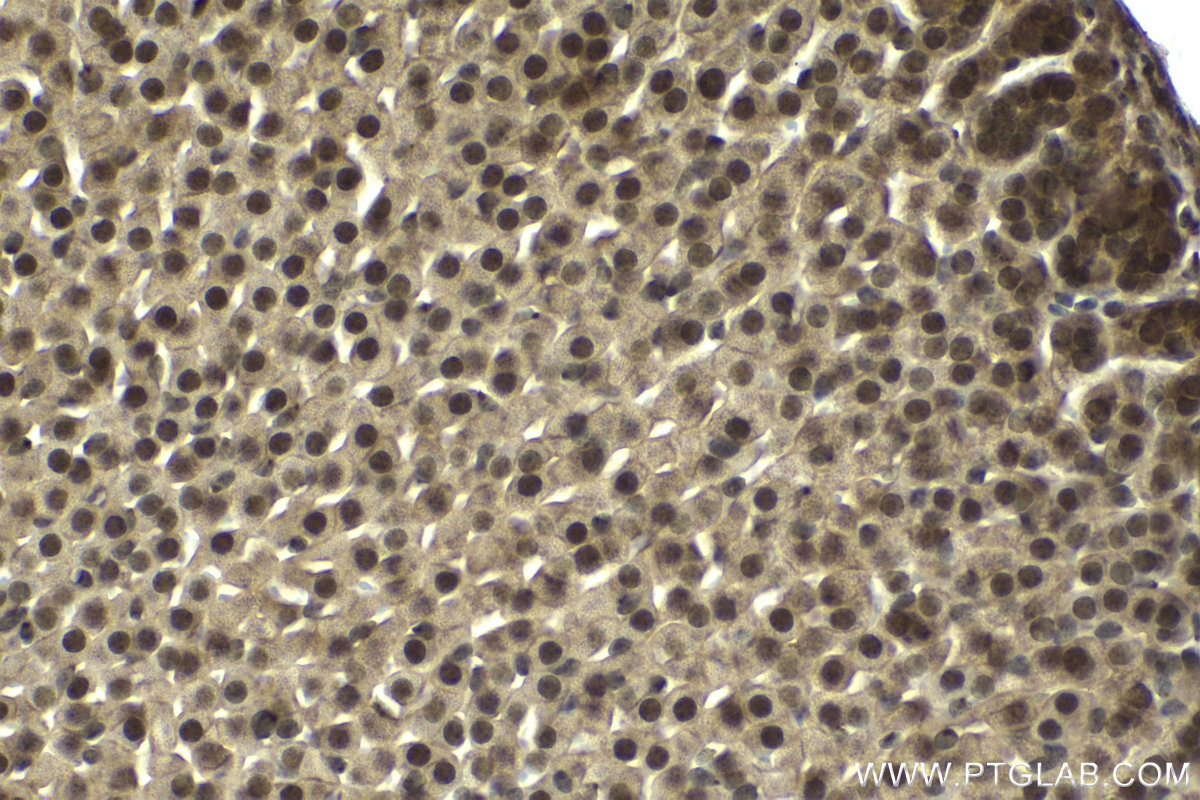 Immunohistochemical analysis of paraffin-embedded mouse adrenal gland tissue slide using KHC2153 (CHEK2 IHC Kit).
