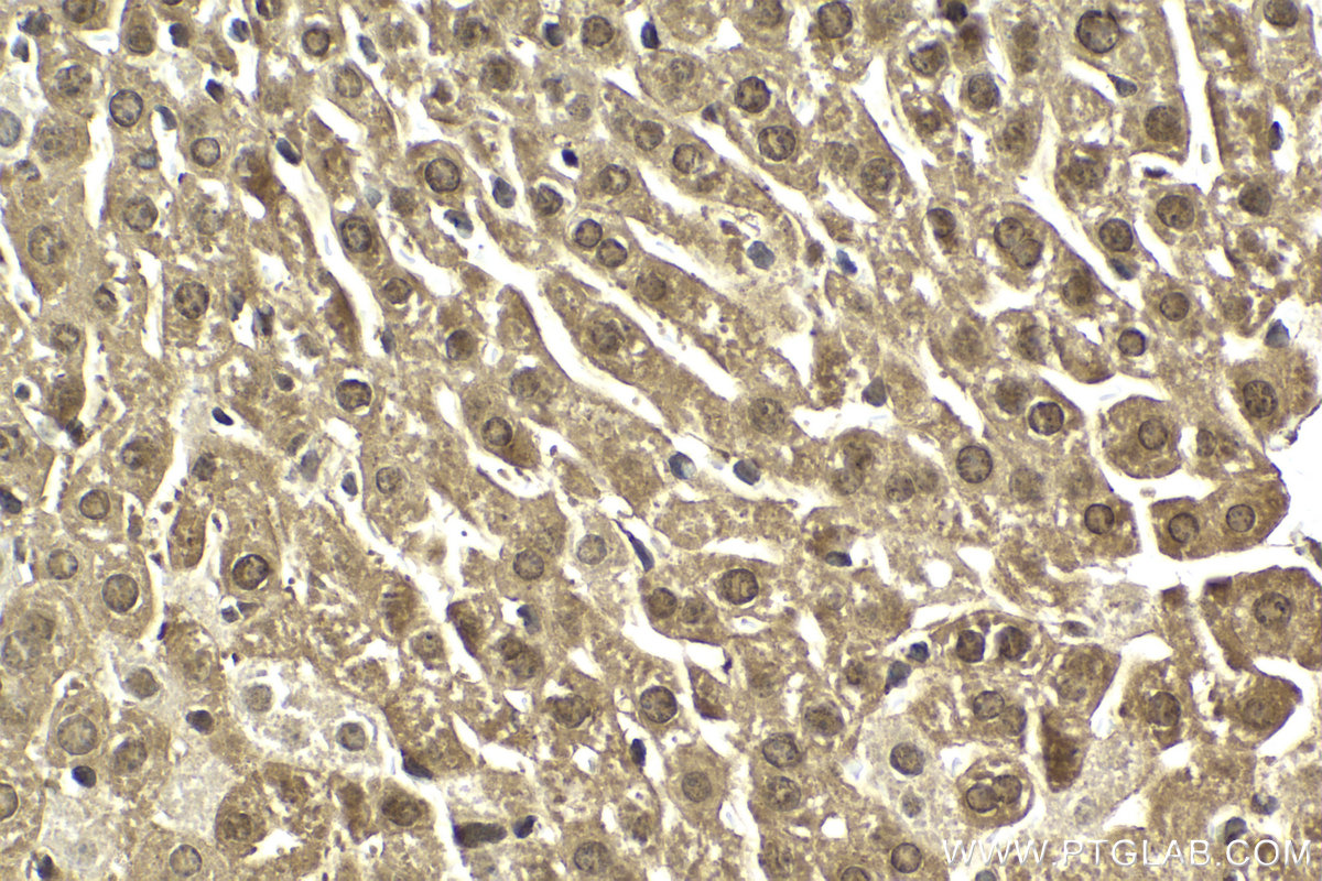 Immunohistochemical analysis of paraffin-embedded mouse liver tissue slide using KHC2153 (CHEK2 IHC Kit).