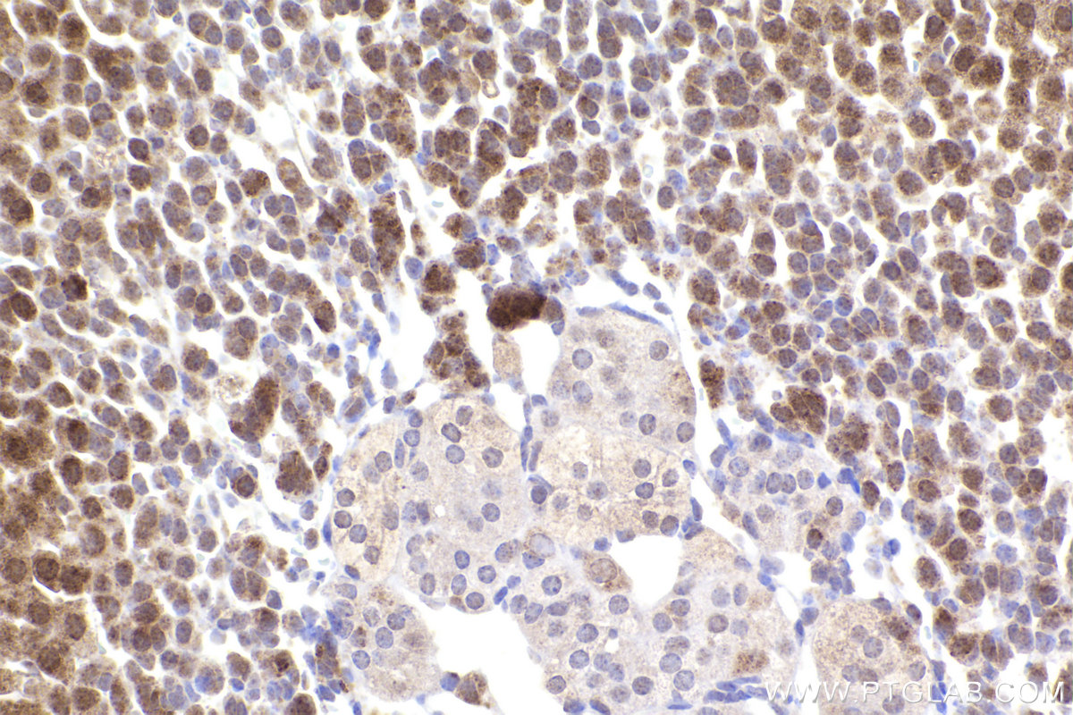 Immunohistochemical analysis of paraffin-embedded mouse adrenal gland tissue slide using KHC2252 (CHRNA7 IHC Kit).