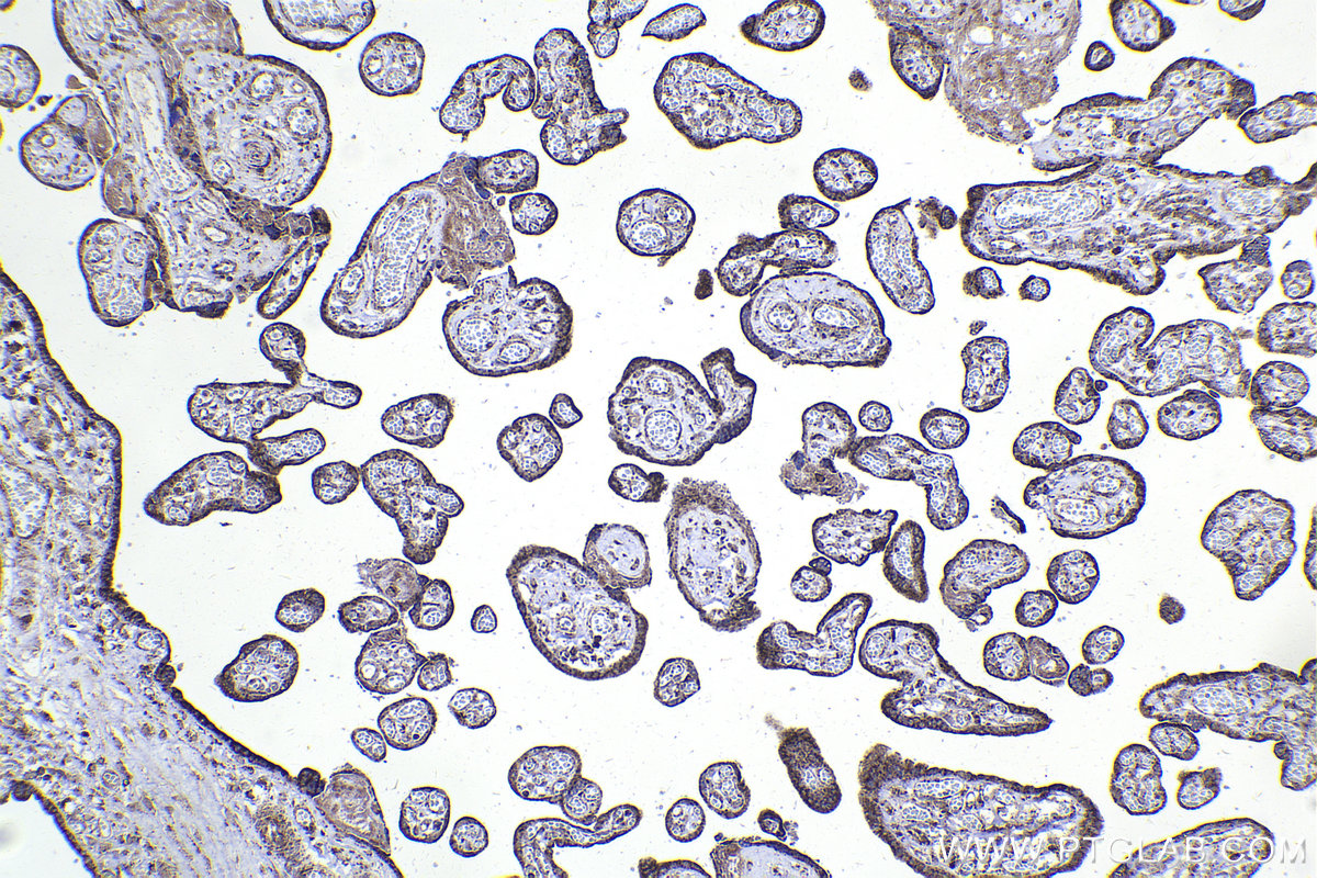 Immunohistochemical analysis of paraffin-embedded human placenta tissue slide using KHC2252 (CHRNA7 IHC Kit).