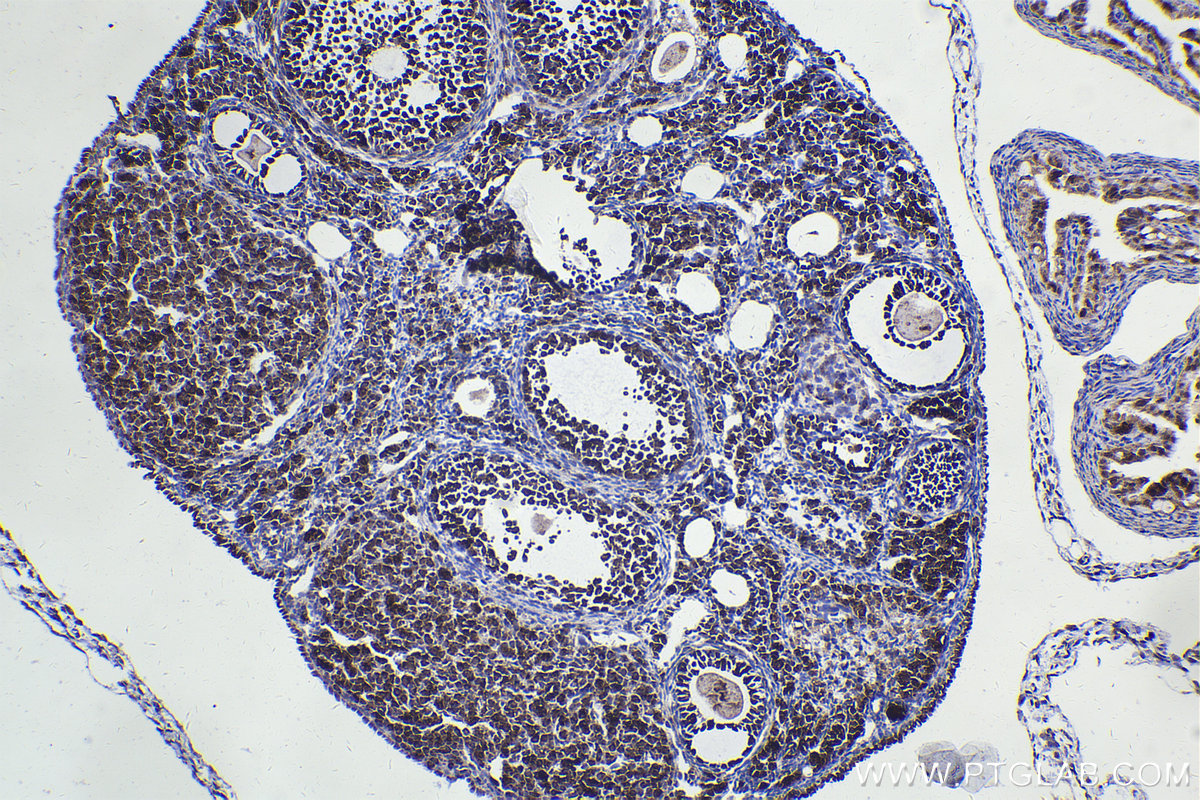 Immunohistochemical analysis of paraffin-embedded mouse ovary tissue slide using KHC2252 (CHRNA7 IHC Kit).